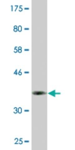Monoclonal Anti-DBF4B antibody produced in mouse