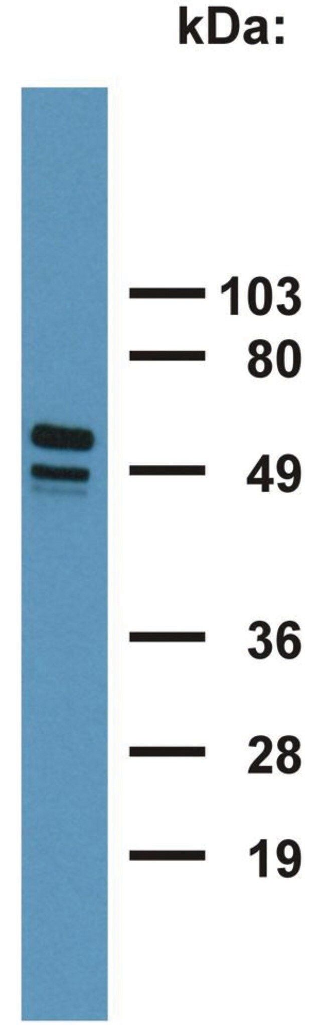 Monoclonal Anti-Cytokeratin 7/17 antibody produced in mouse