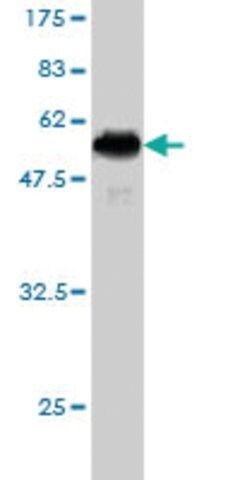 Monoclonal Anti-DC-UbP antibody produced in mouse