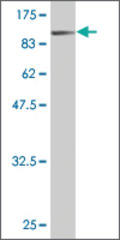 Monoclonal Anti-BFSP1 antibody produced in mouse