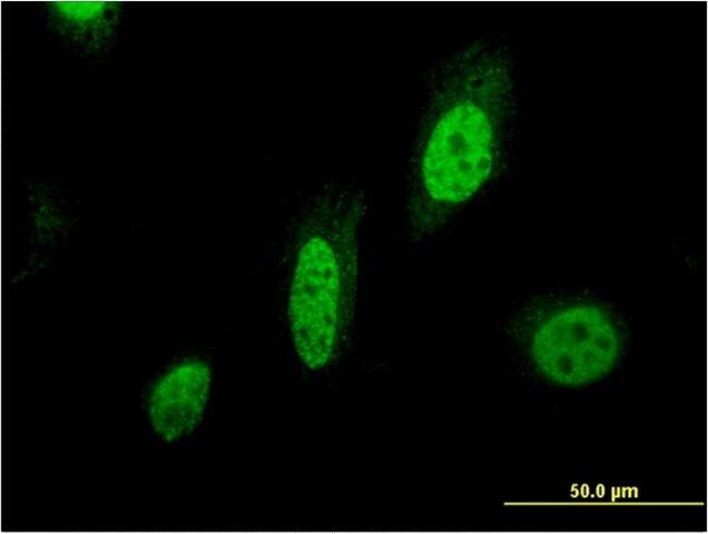 Monoclonal Anti-BIRC7, (N-terminal) antibody produced in mouse