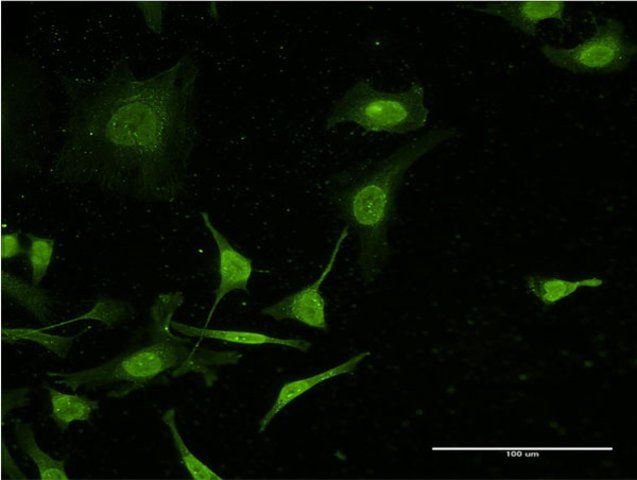 Monoclonal Anti-C4B antibody produced in mouse