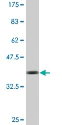 Monoclonal Anti-CCDC5, (C-terminal) antibody produced in mouse
