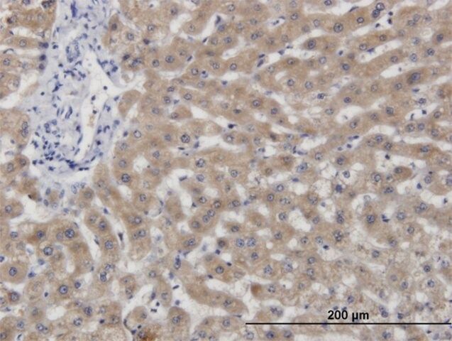 Monoclonal Anti-CBS, (N-terminal) antibody produced in mouse