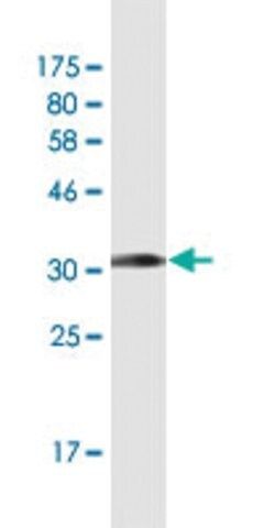 Monoclonal Anti-CCL2 antibody produced in mouse