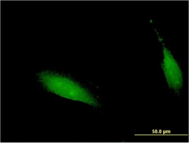 Monoclonal Anti-CENPV antibody produced in mouse