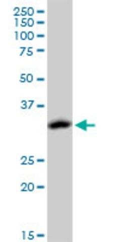 Monoclonal Anti-ACOT8 antibody produced in mouse