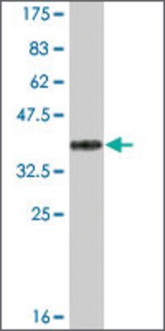 Monoclonal Anti-ACACB antibody produced in mouse