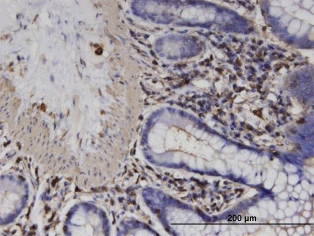 Monoclonal Anti-ACTRT2 antibody produced in mouse