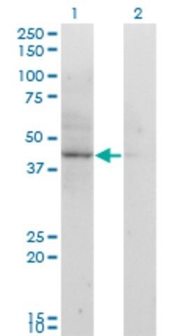 Monoclonal Anti-ACAT2 antibody produced in mouse