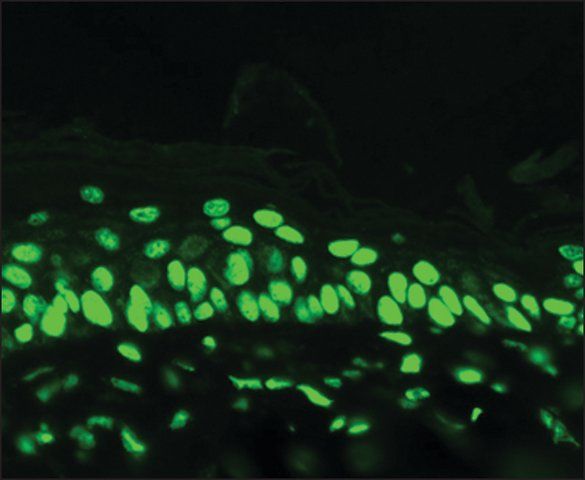 Monoclonal Anti-Acetylated Lysine antibody produced in mouse