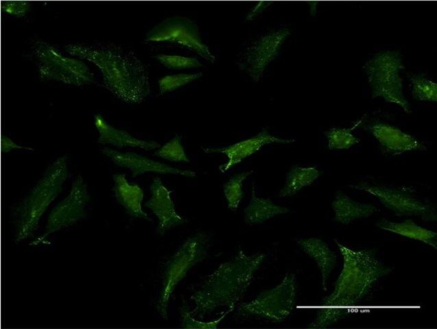 Monoclonal Anti-ABCB9 antibody produced in mouse