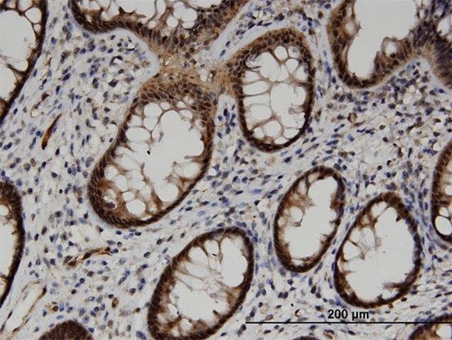 Monoclonal Anti-ACOT7, (N-terminal) antibody produced in mouse