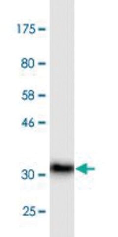 Monoclonal Anti-ADAM2 antibody produced in mouse