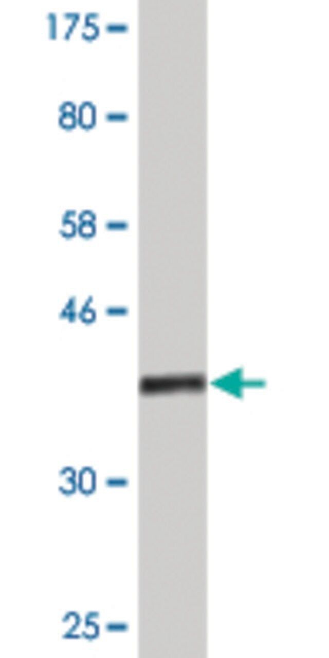Monoclonal Anti-ASH2L antibody produced in mouse