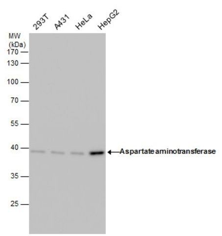 Monoclonal Anti-Aspartate aminotransferase antibody produced in mouse