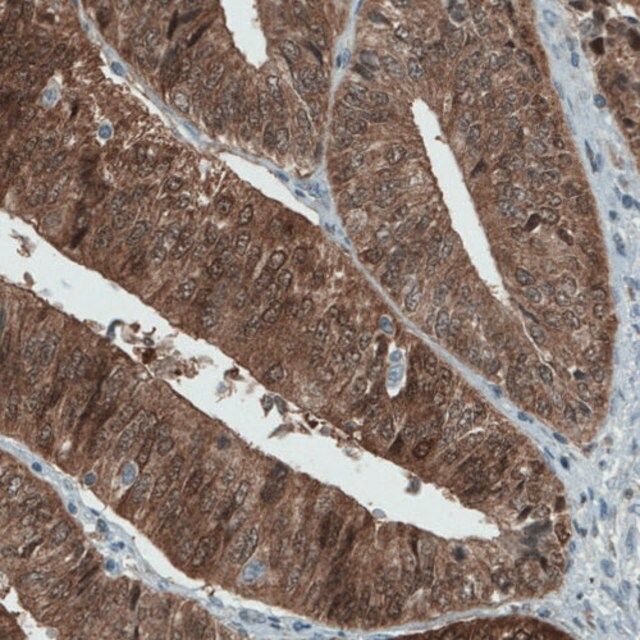 Monoclonal Anti-ASRGL1 antibody produced in mouse