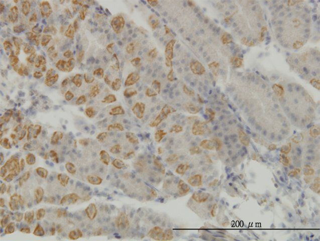 Monoclonal Anti-AATK antibody produced in mouse