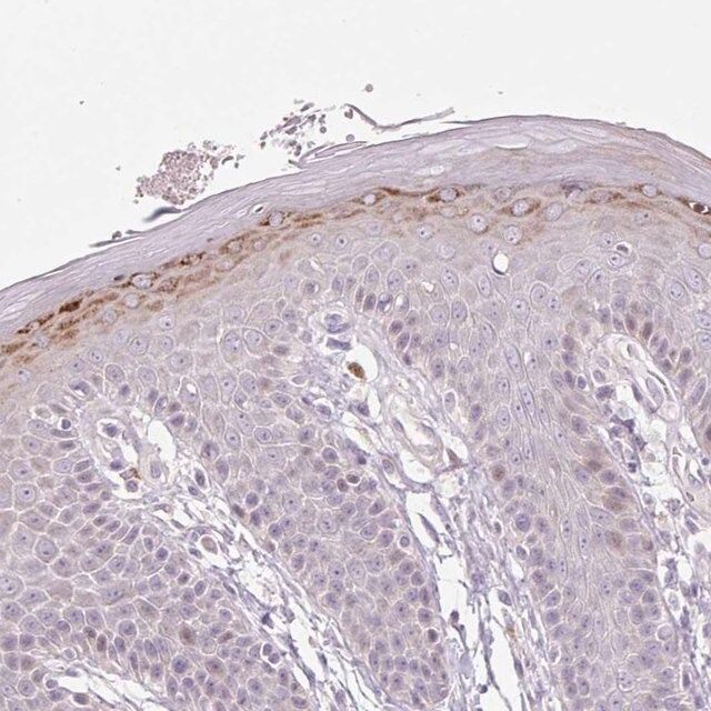 Anti-ZNF814 antibody produced in rabbit