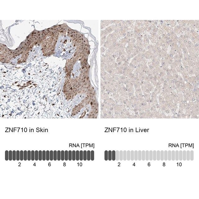 Anti-ZNF710 antibody produced in rabbit