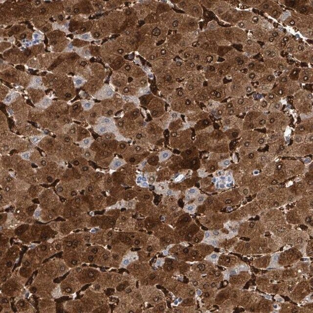 Anti-ZNF771 antibody produced in rabbit