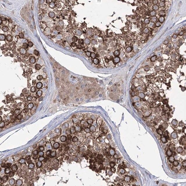 Anti-ZNF622 antibody produced in rabbit