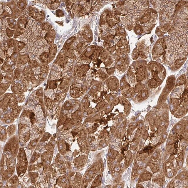 Anti-ZNF285 antibody produced in rabbit