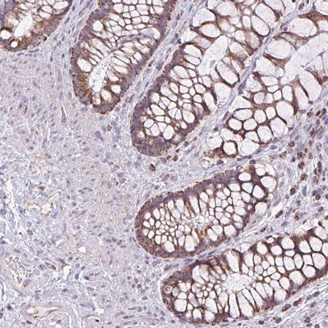 Anti-ZNF362 antibody produced in rabbit