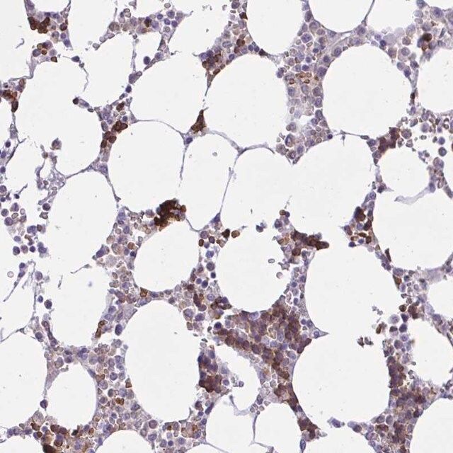 Anti-ZNF221 antibody produced in rabbit