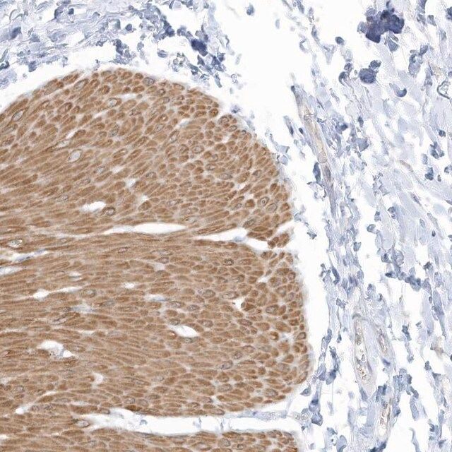 Anti-ZNF846 antibody produced in rabbit