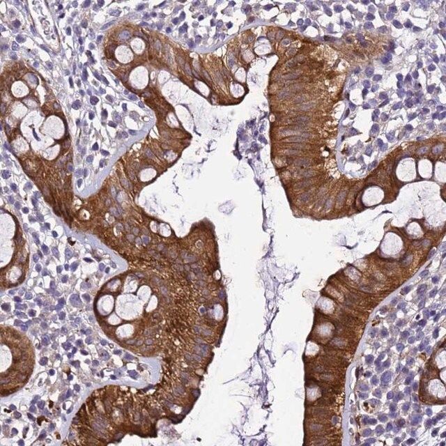 Anti-ZNF587 antibody produced in rabbit