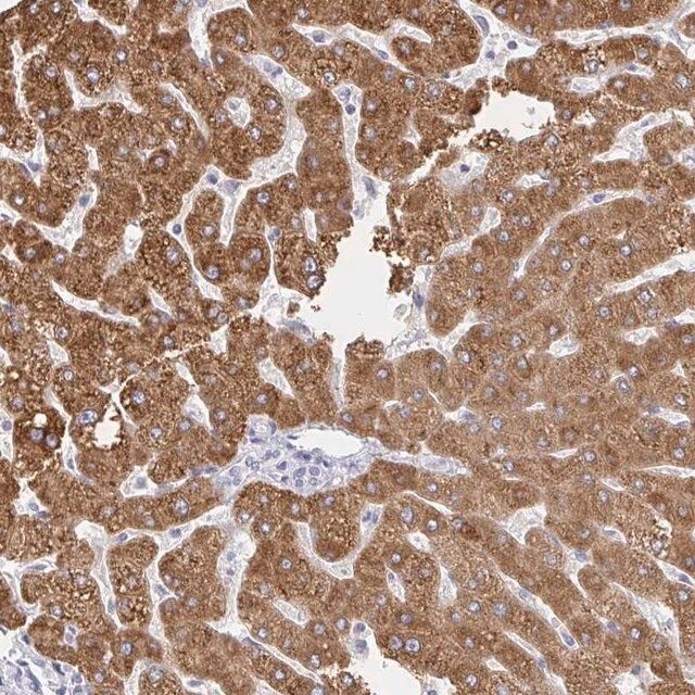 Anti-ZNF100 antibody produced in rabbit