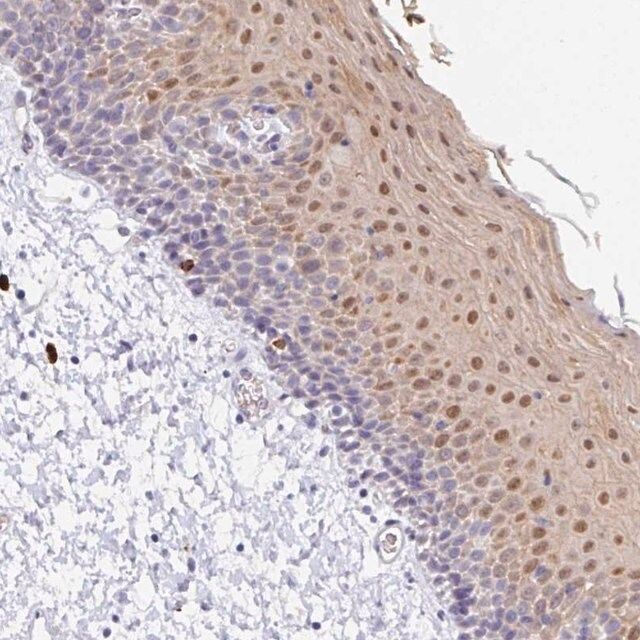 Anti-ZNF684 antibody produced in rabbit