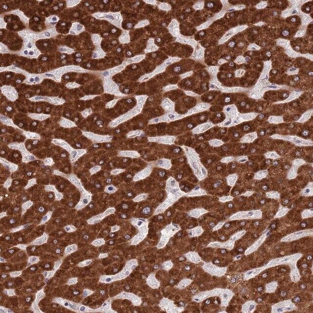 Anti-ZNF140 antibody produced in rabbit