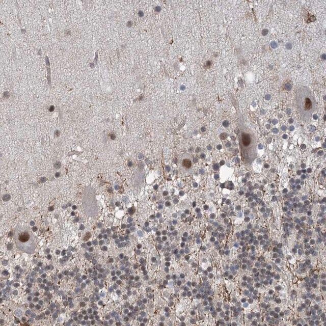 Anti-ZNF8 antibody produced in rabbit