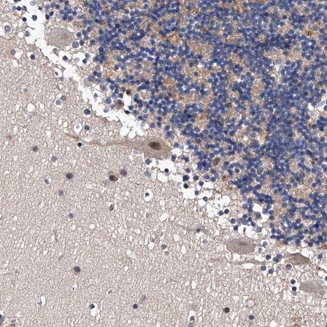 Anti-ZNF30 antibody produced in rabbit