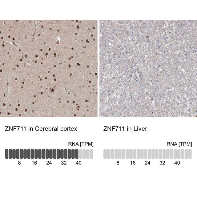 Anti-ZNF711 antibody produced in rabbit