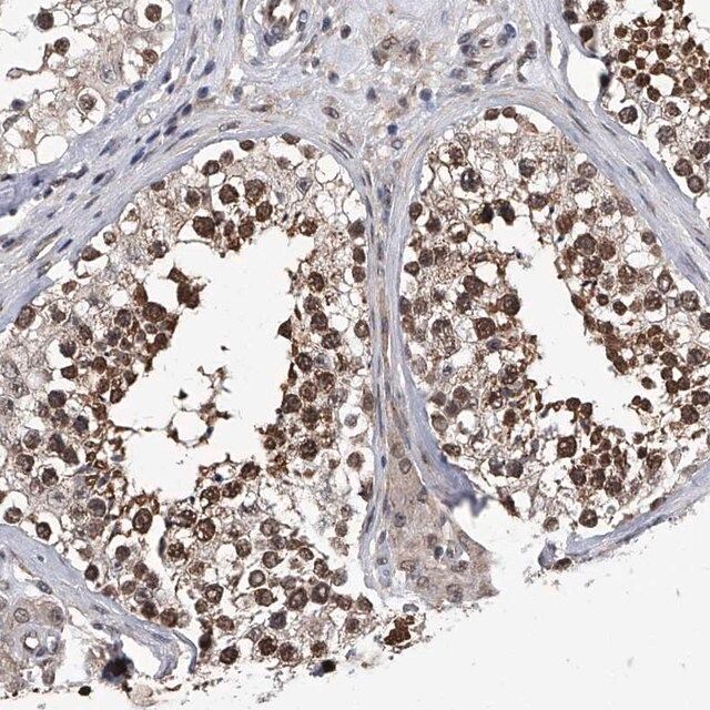 Anti-ZNF76 antibody produced in rabbit
