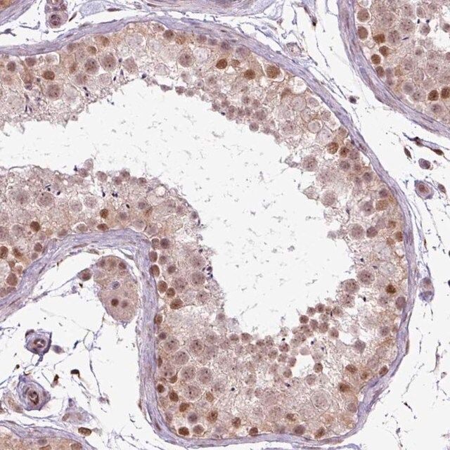 Anti-ZC2HC1C antibody produced in rabbit