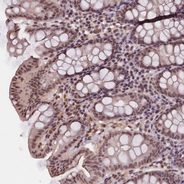 Anti-ZC3H4 antibody produced in rabbit