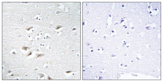 Anti-ZEB2 antibody produced in rabbit