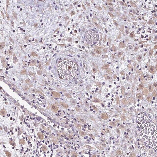 Anti-ZFP1 antibody produced in rabbit