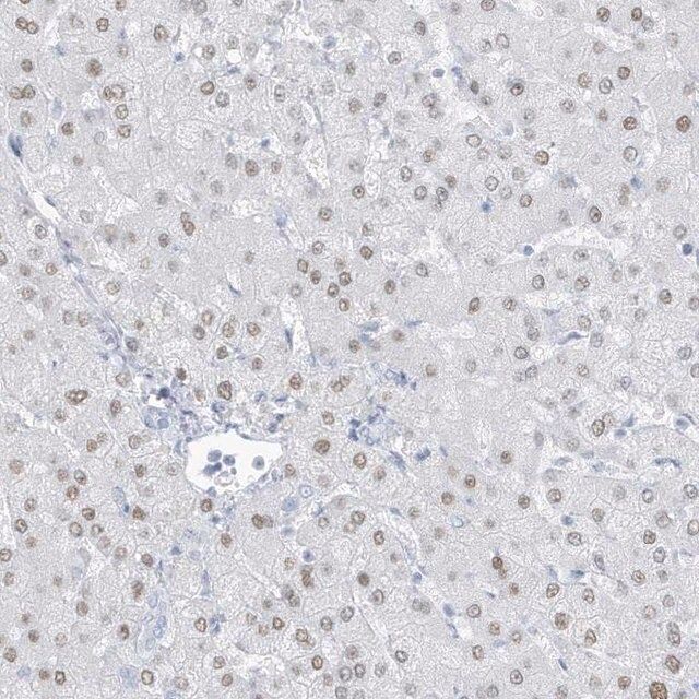 Anti-ZFP64 antibody produced in rabbit