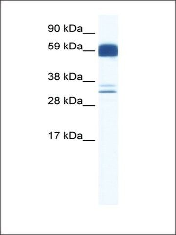 Anti-ZIC5 antibody produced in rabbit