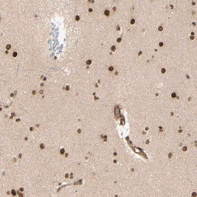 Anti-ZMYM6 antibody produced in rabbit