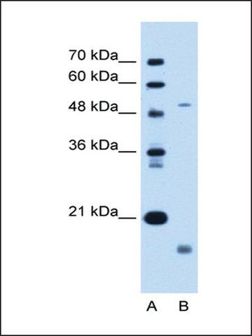 Anti-ZMPSTE24 antibody produced in rabbit