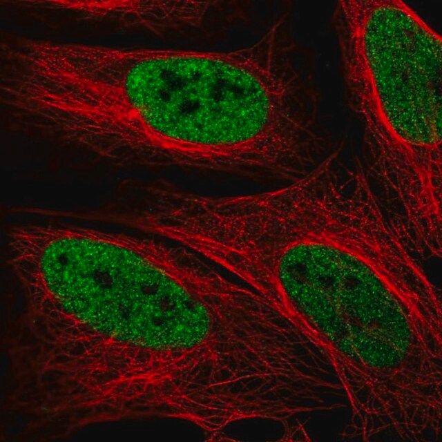 Anti-ZMYM3 antibody produced in rabbit