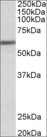 Anti-ZNF703 antibody produced in goat