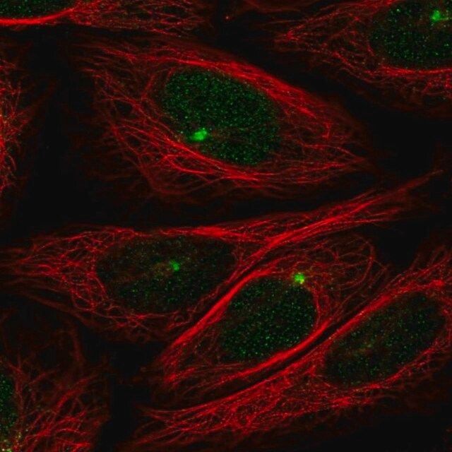 Anti-ZMYM1 antibody produced in rabbit