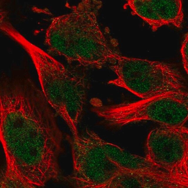 Anti-ZNF655 antibody produced in rabbit